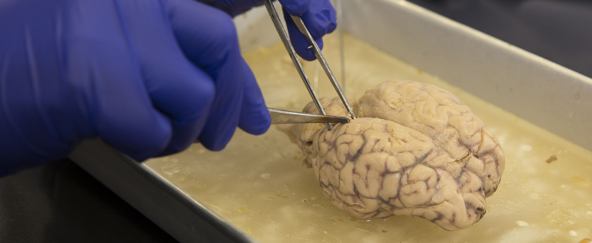 Dissecting A Brain